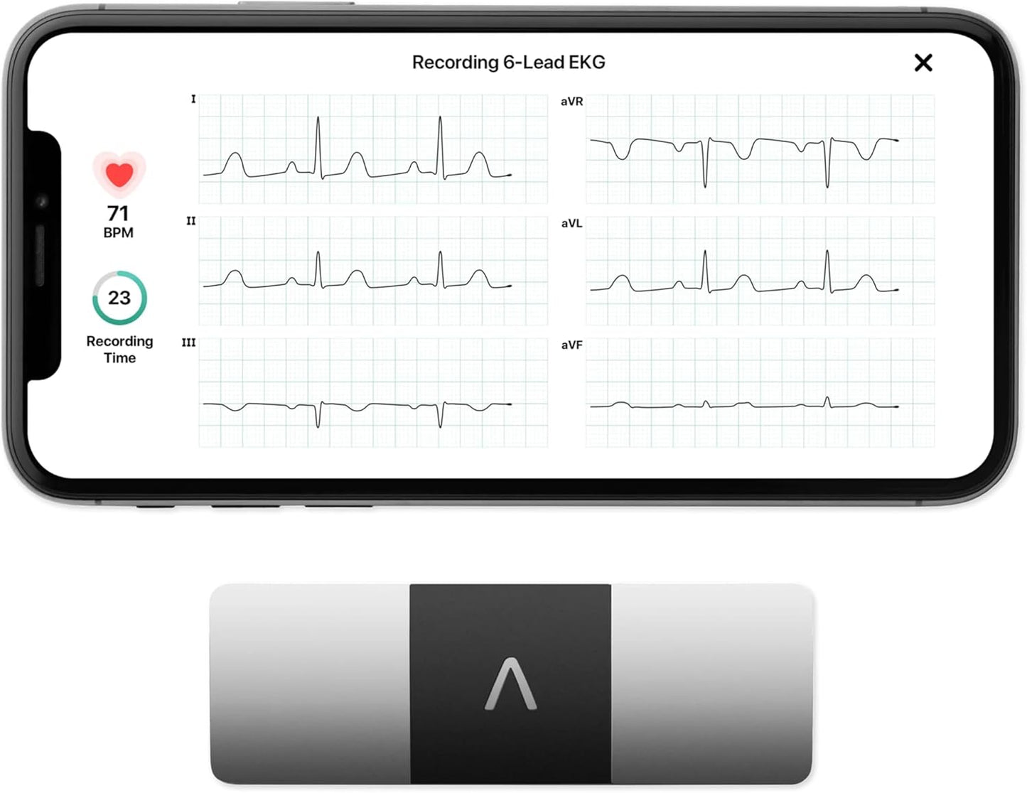 AliveCor KardiaMobile 6L ECG di livello medico | L’ECG Portatile a 6 Derivazioni | Rileva la Fibrillazione Atriale, Bradicardia e Tachicardia in Soli 30 Secondi | Distribuito da OMRON